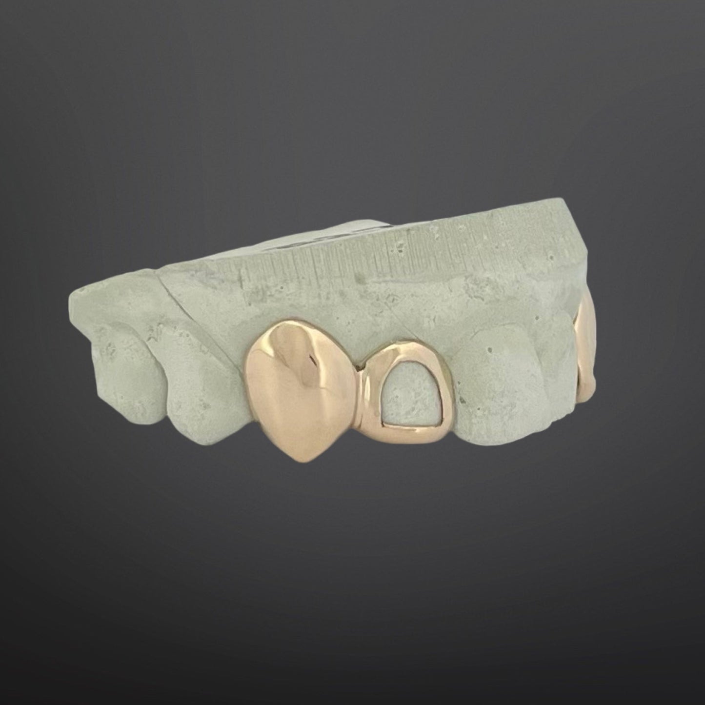 Solid Plain Fangs And Open Face Four Teeth With Back Bar Top Set Natural Gold