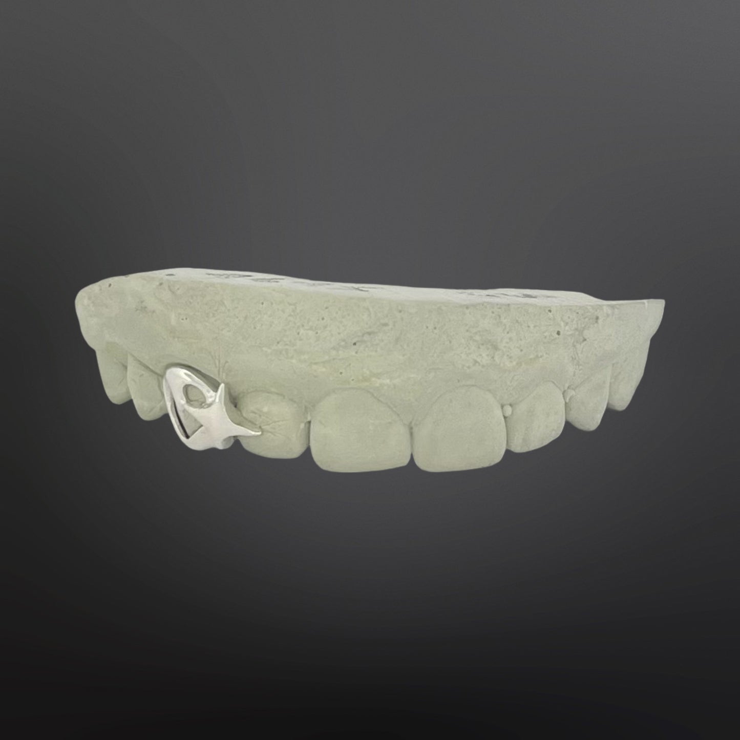 Heart Open Face with Star Spacer Single