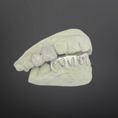 Diamond Dust Top Two Teeth And Drip Design Bottom Six Teeth Full Set Silver White